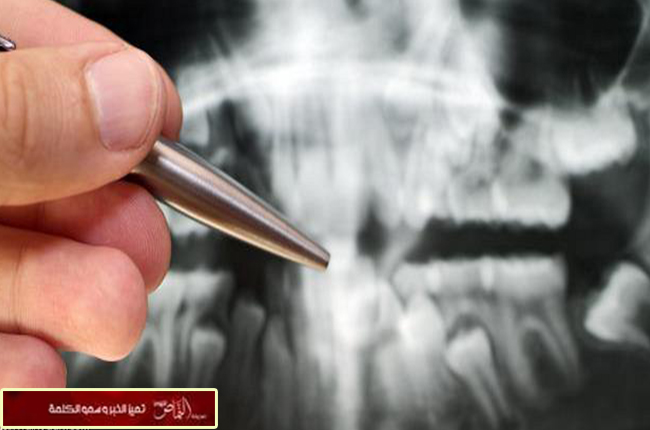 سويدي يهرب من السجن ليعالج أسنانه