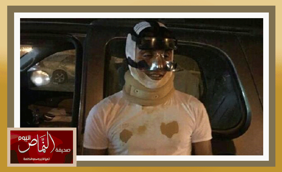 أحمد الشهري .. يصاب بجروح بسبب انقاذ حياة أسرة على طريق الرين