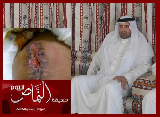 مريضة بمستشفى النماص جرحها لم يلتئم منذ 3 أسابيع